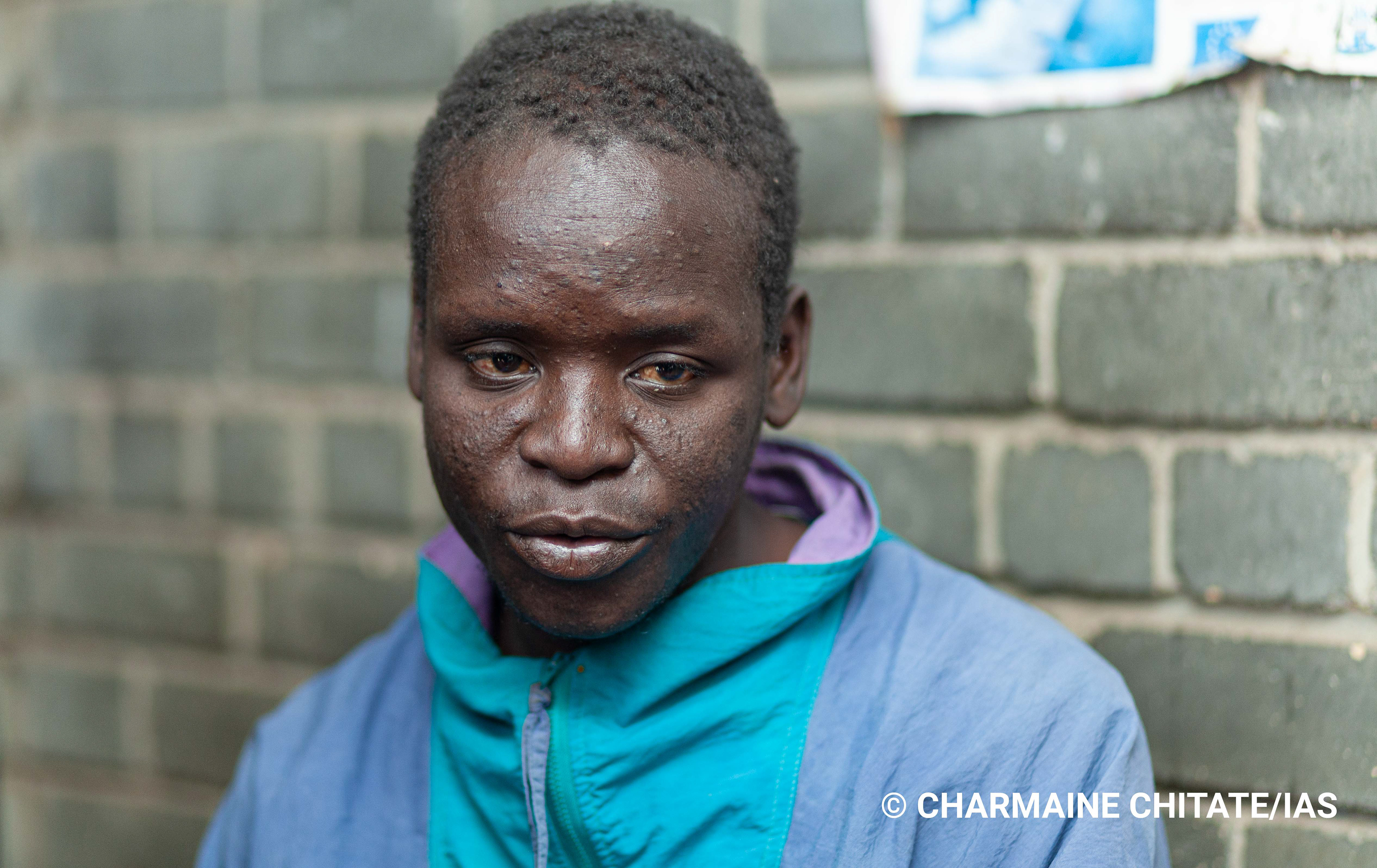 Blessing Chingwaru, 29, is a self-taught motor mechanic and was diagnosed with TB in February 2019. (Photographer: Charmaine Chitate/IAS)