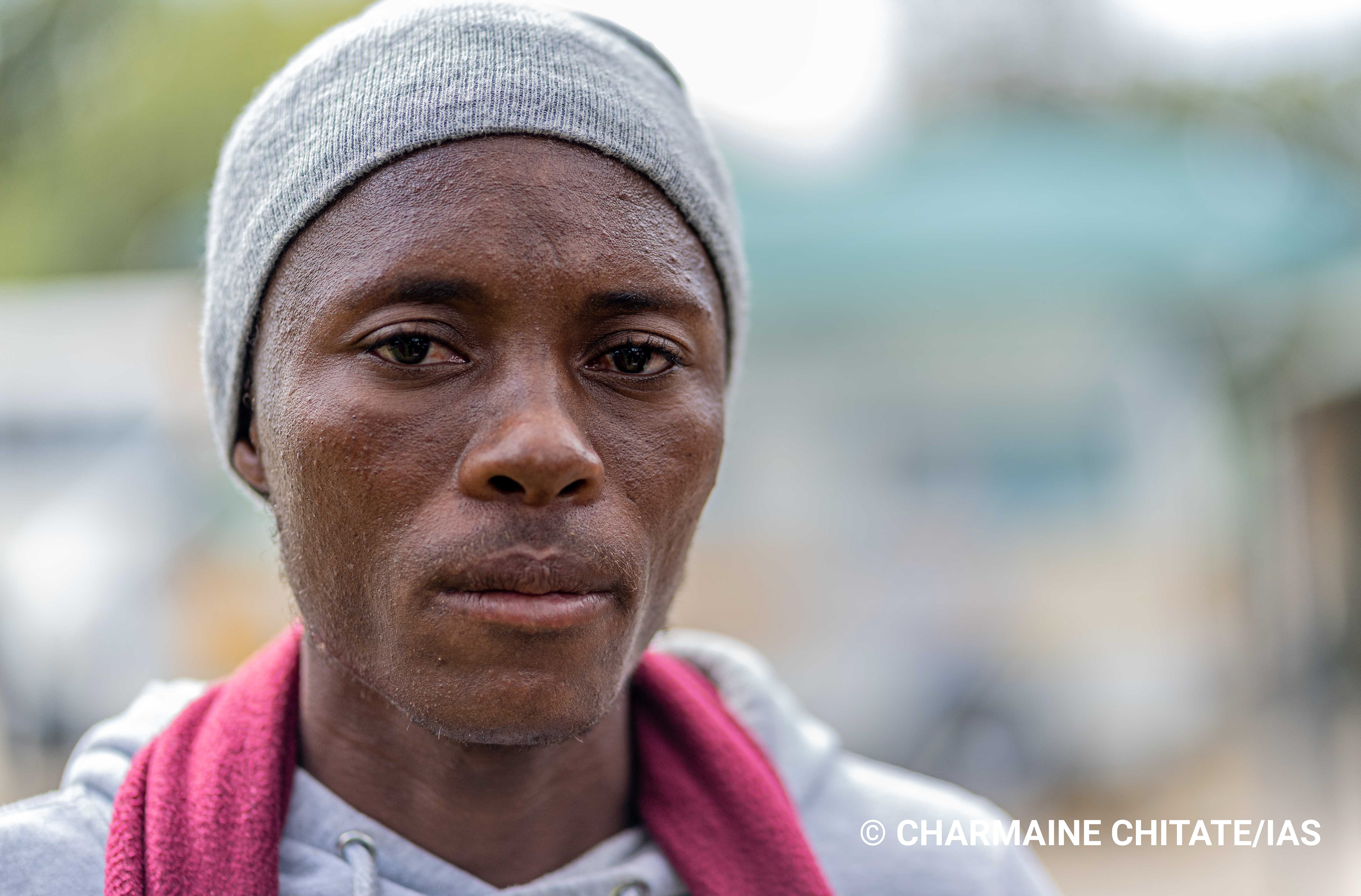 Kanukai Steward, is receiving treatment for TB from Ngezi Medical Clinic and to support his recovery, ZIMPLATS have re-assigned him to above-ground postings only. (Photographer: Charmaine Chitate/IAS)