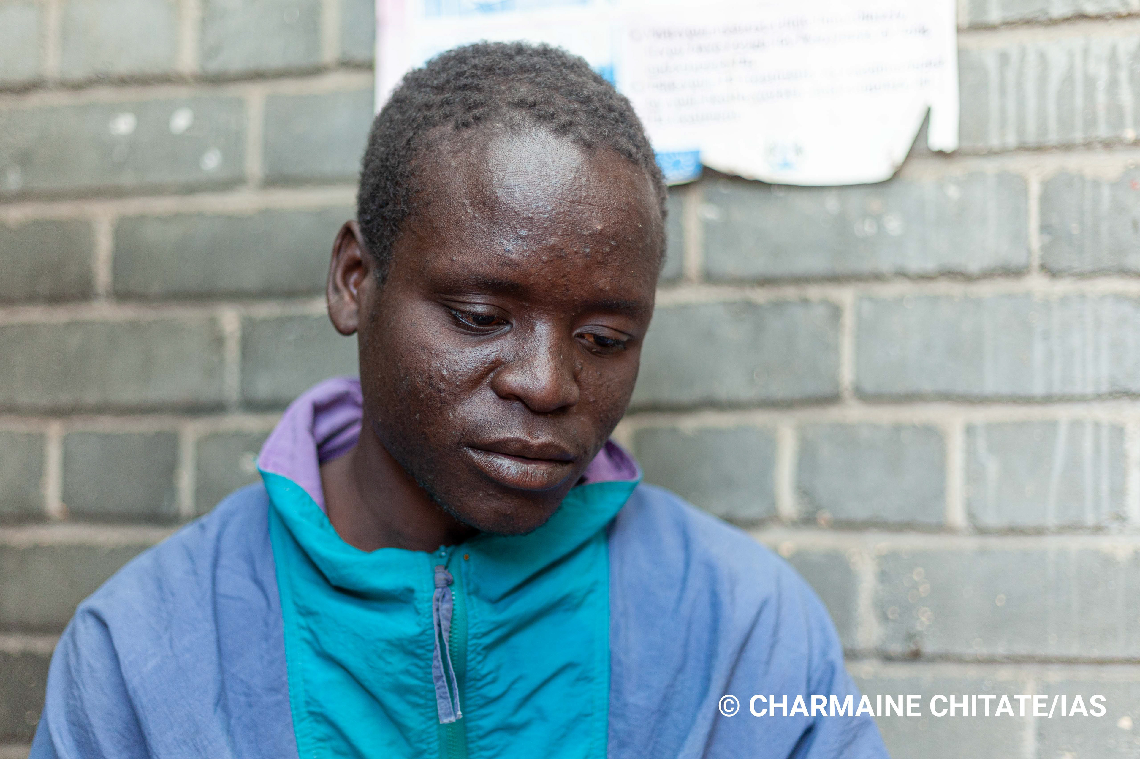 In 2016, 29 year-old Blessing Chingwaru tested positive for HIV and in February 2019, he was diagnosed with TB following a sputum test. (Photographer: Charmaine Chitate/IAS)