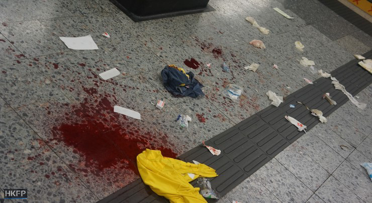 Source: https://www.hongkongfp.com/2015/09/21/bloody-knife-attack-inside-jordan-mtr-station-injures-three-as-rush-hour-commuters-flee-in-horror/