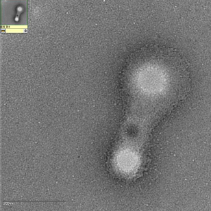 TEM - Liposomes Fused Together