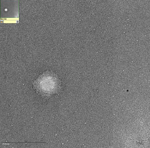 TEM - Liposome