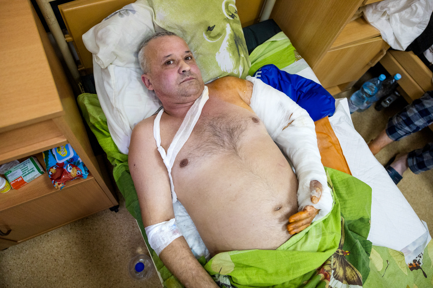 Lastensairaalassa hoidetaan tällä hetkellä myös rintamalta tuotuja sotilaita, jotka tarvitsevat leikkaushoitoa. Yksi heistä on Pavlo. Kiova, Ukraina, 2023