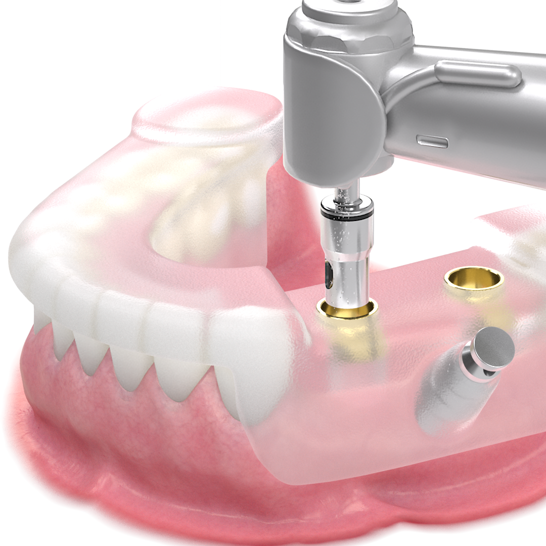 歯科医療機器の３DCGプロモーションビデオからの静止画像