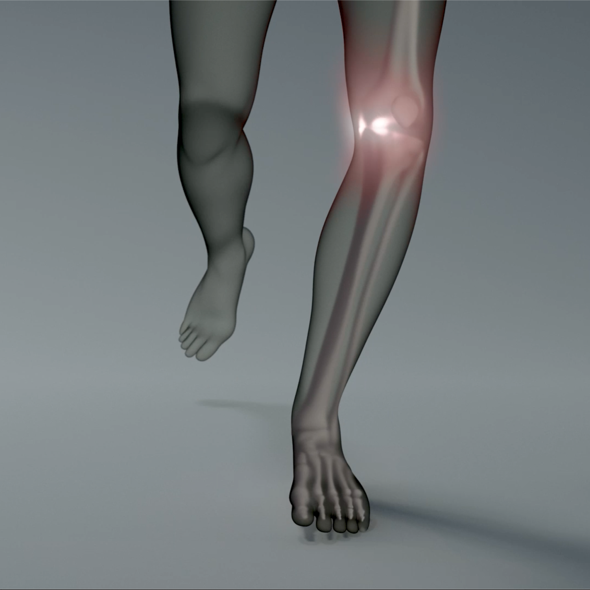 変形性関節症の簡単な説明