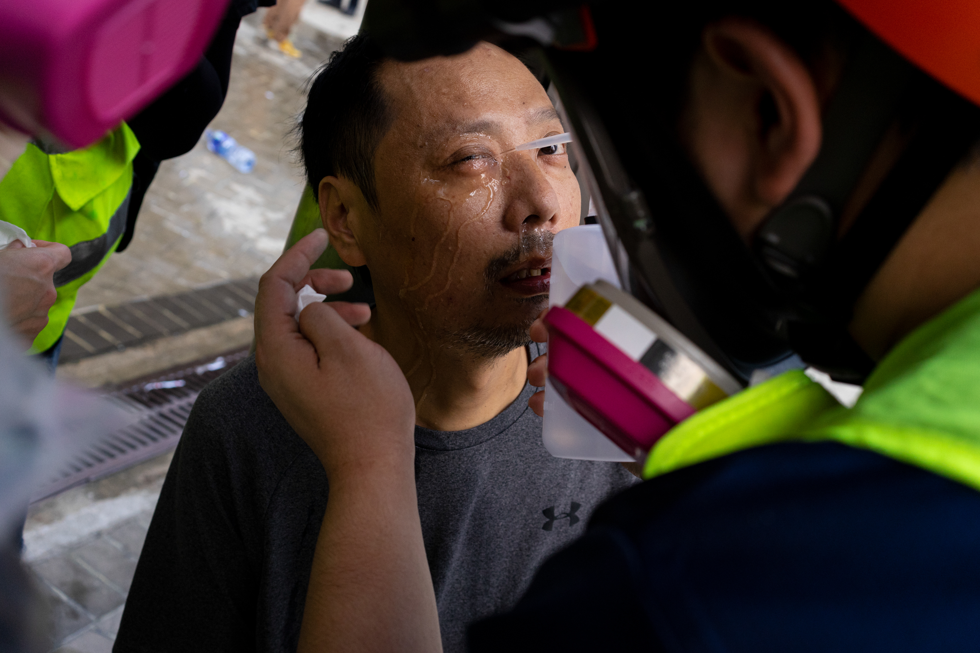 Gassed: Admiralty, Hong Kong: In an odd turn, Hong Kong police bring a man who was tear gassed to Nok and his crew. They wash out his eyes, give him some water and advise him to get out of the area. Following the 5th anniversary of the Umbrella Movement, protesters encounter violence from police on a scale that has not been seen before. September 29, 2019-Hong Kong