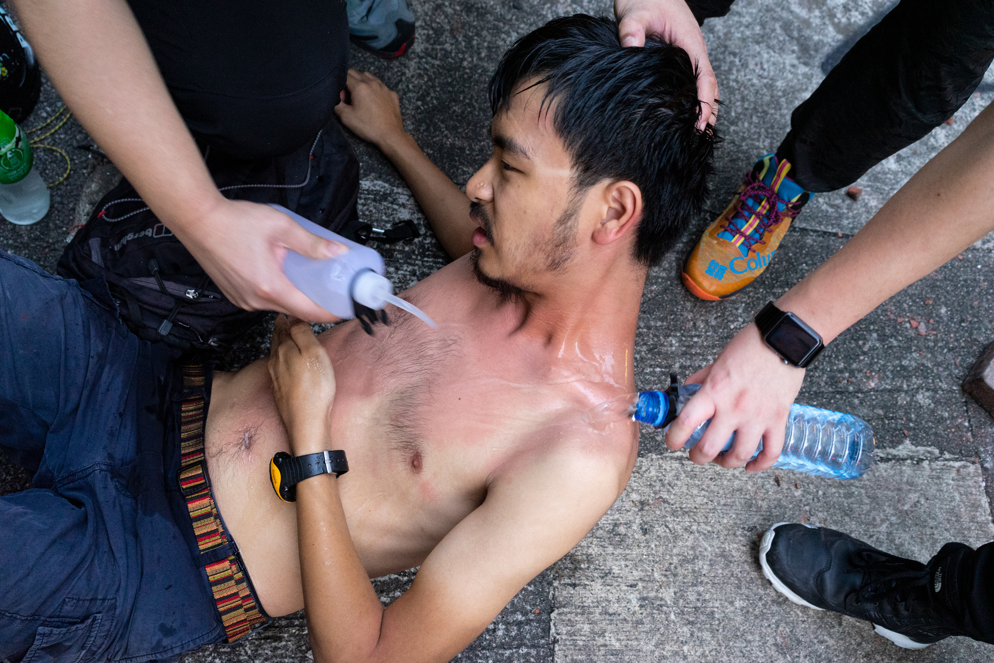 Burned Reporter: Causeway Bay, Hong Kong: A reporter requests help. His skin burning from tear gas and pepper spray. The boys get to work trying to rinse him off. Following the 5th anniversary of the Umbrella Movement, protesters encounter violence from police on a scale that has not been seen before. September 29, 2019-Hong Kong