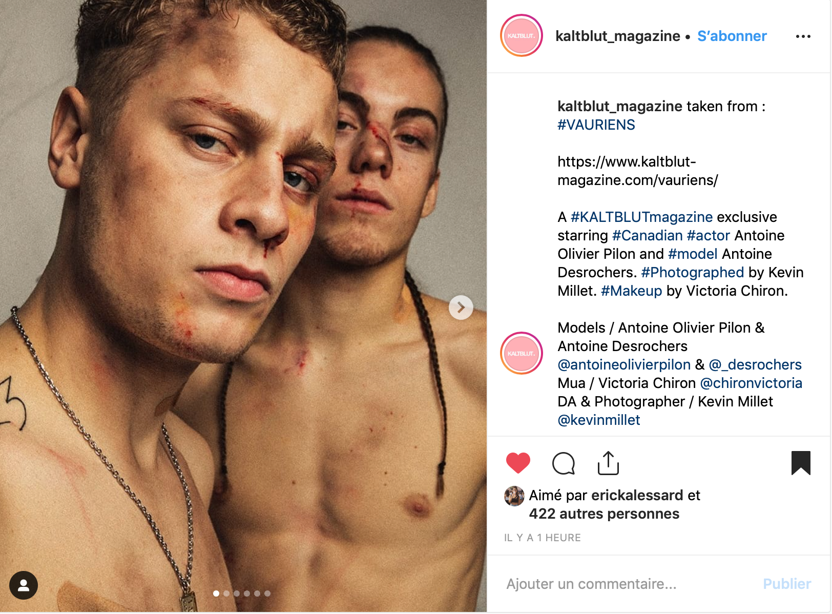 https://www.instagram.com/p/Bwwblm4l0Tn/