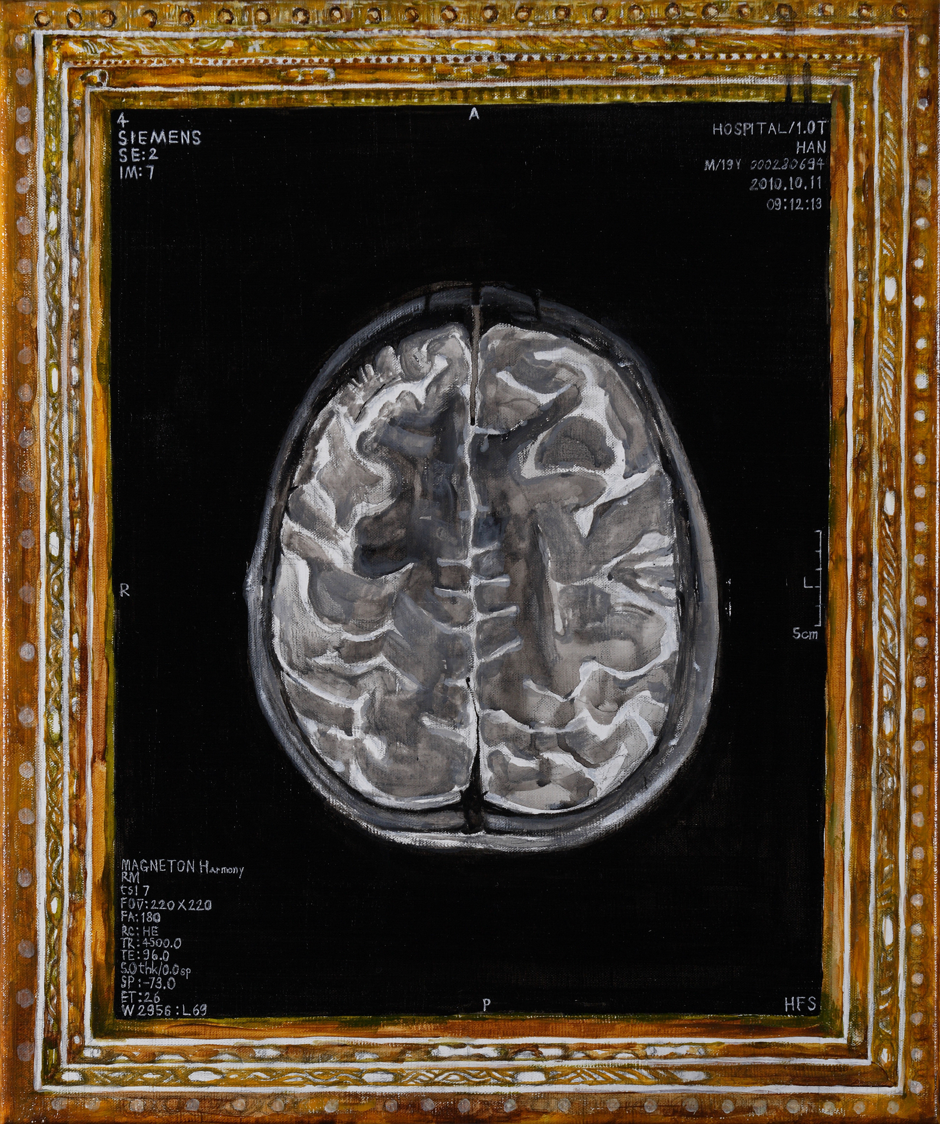 Self-portrait, Acrylic on canvas, 60.6x50.0cm, 2013