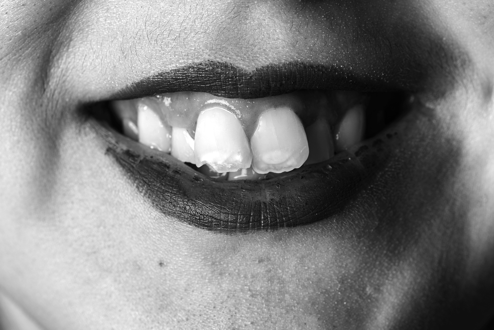 On s ' est beaucoup moqué de mes dents car elles me font ressembler à un lapin, je les cachent sur les photos maintenant.