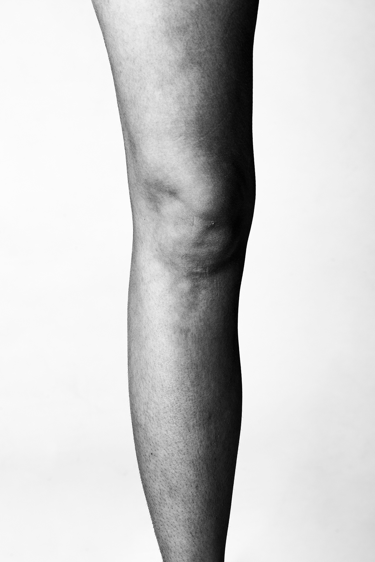Mes jambes mesurent un mètre chacune et je fais 1m83. J'ai souvent mal vécu ma grande taille à cause des remarques.