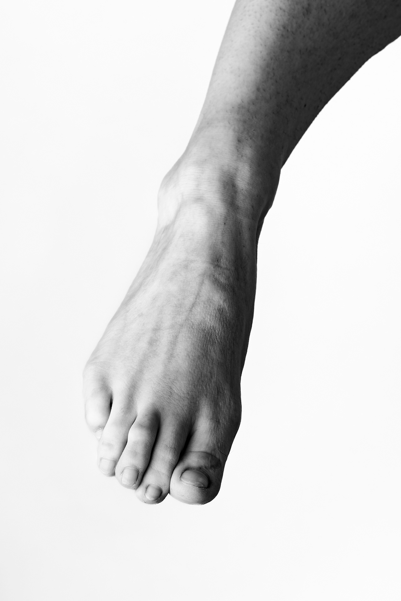 Je suis trop mal à l'aise à l'idée que des gens voient mes pieds.