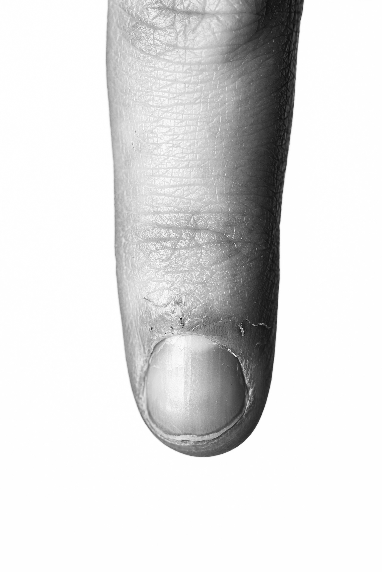 Les peaux sur mes doigts et la forme de mes ongles ne fait pas féminin, ça affecte ma confiance en moi.