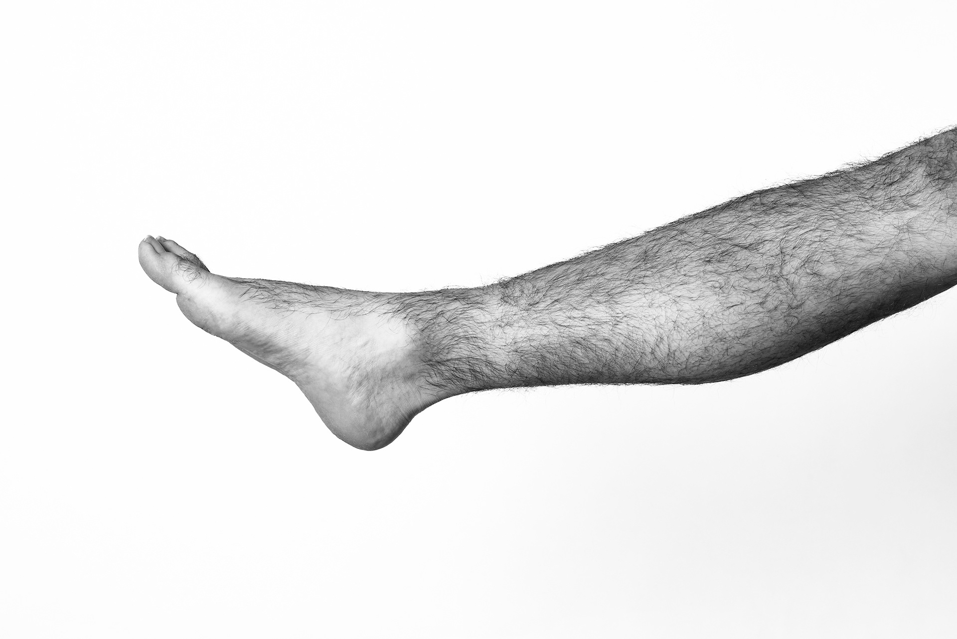 Mes jambes ont trop de poils, ce n'est pas très esthétique.