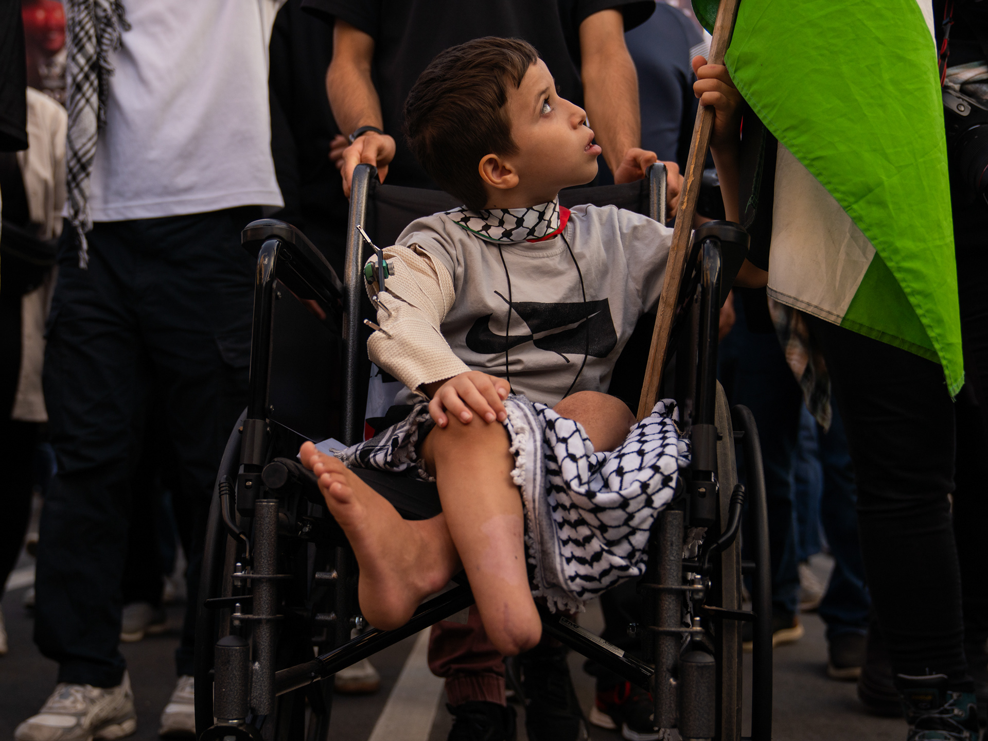 Chicago — 7-year-old Baraa Alroos, from Rafah, Gaza, lost part of his leg in a bombing in early 2024. His father and grandmother were also killed in the attack. 