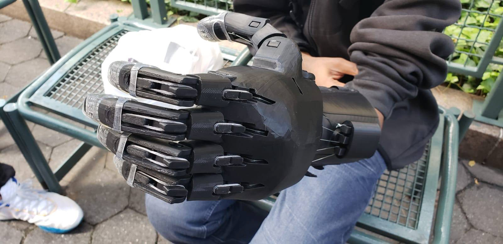 The recipient trying on the prosthetic for the first time.