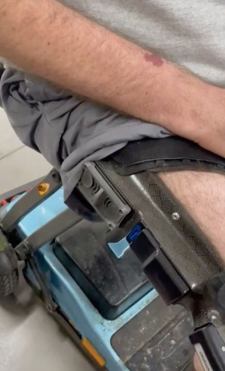 The button installed on the prosthetic.
