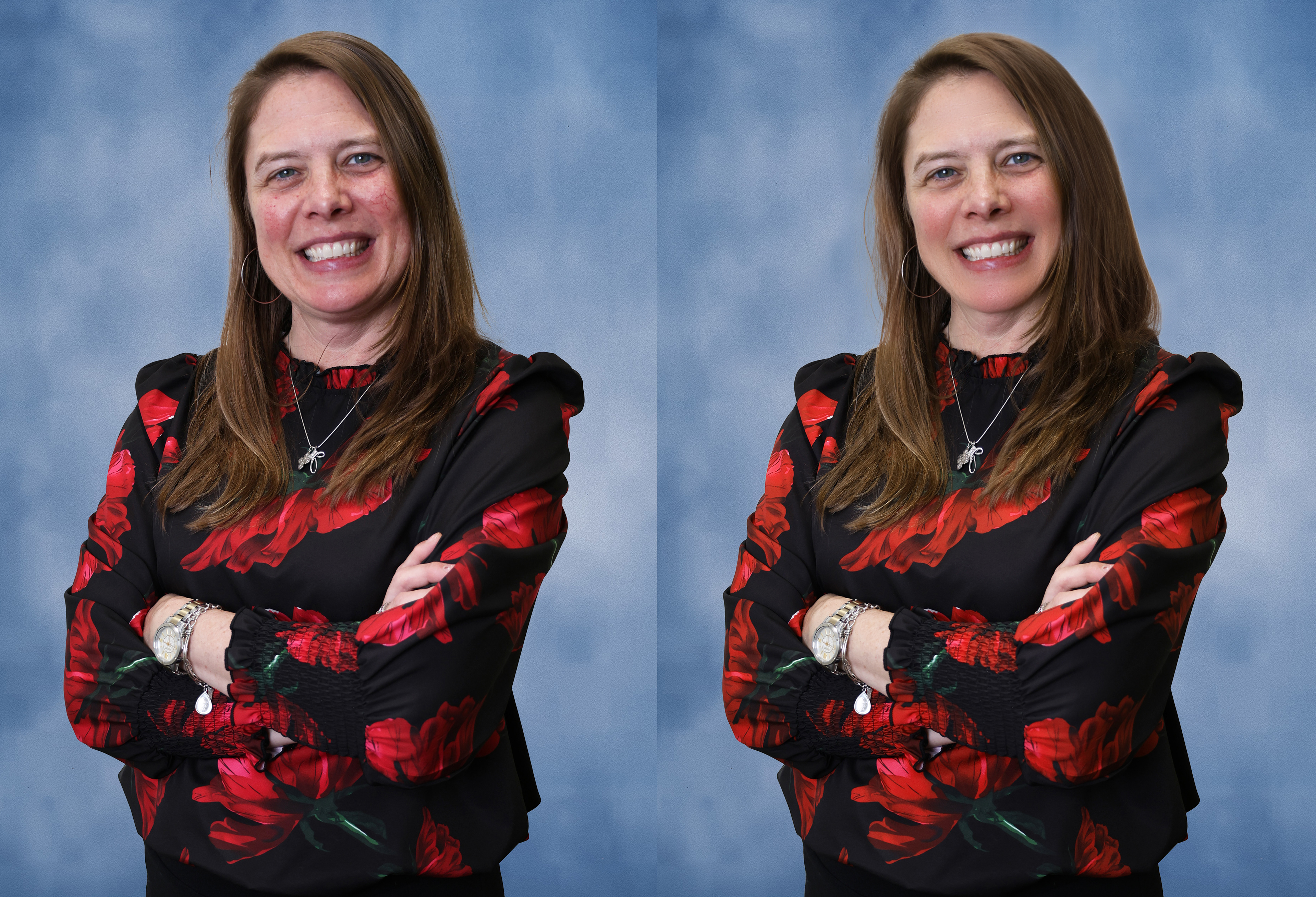 Photo Retouching: Client requested general smoothing, thicker hair, and redness removal.