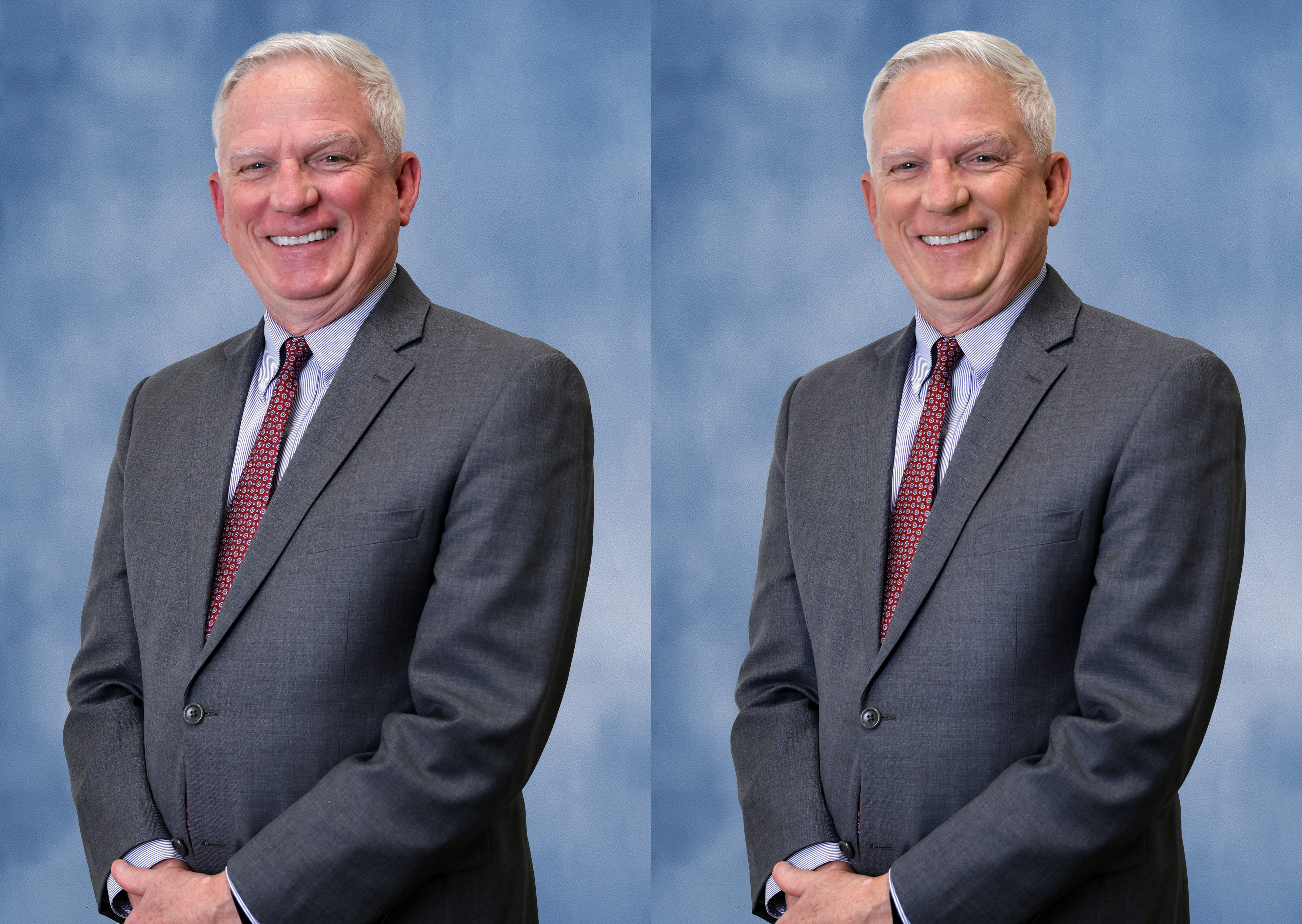 Phot Retouching: Client requested redness removal and slimming.