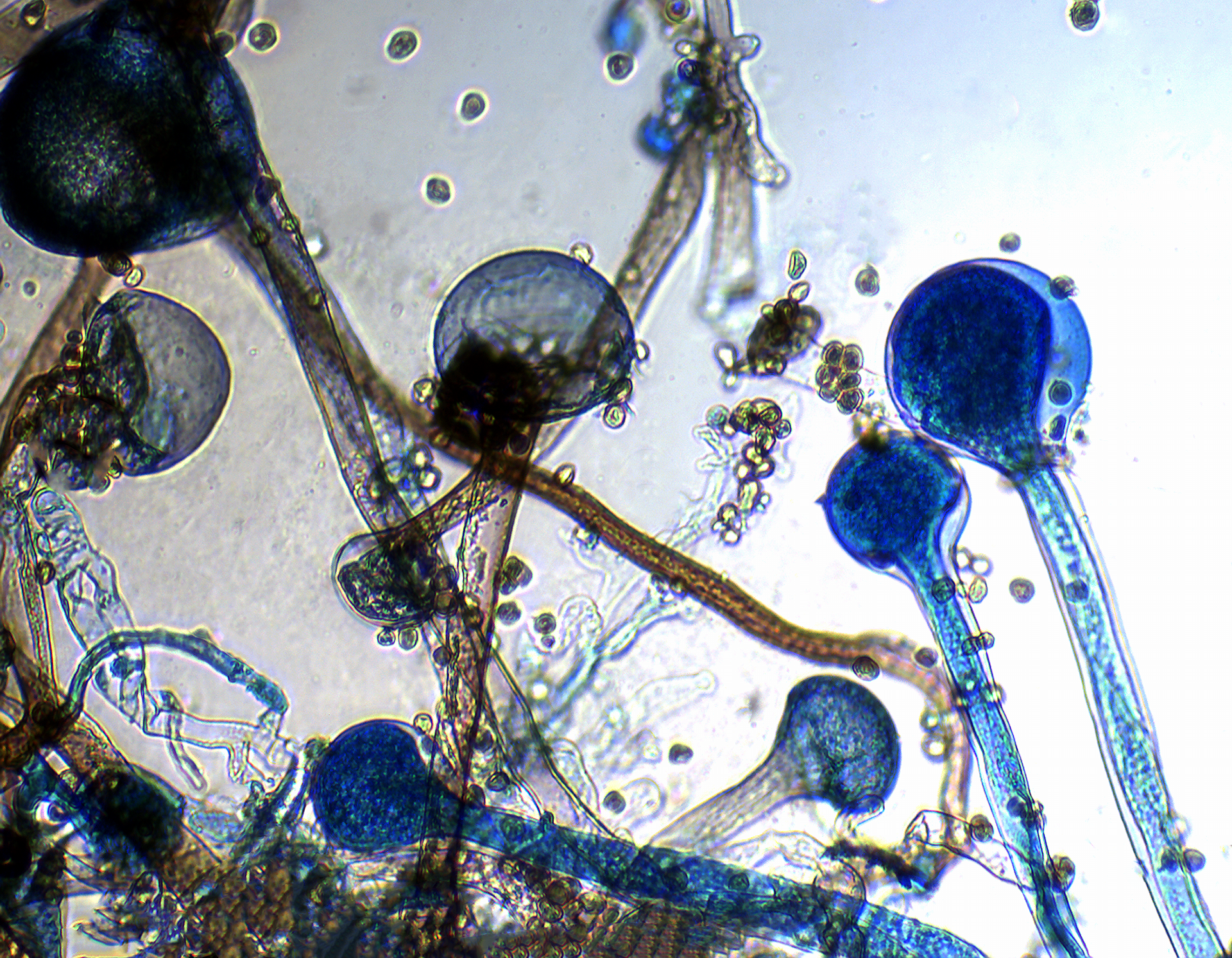 Original photomicrograph. Rhizopus Stolonifer var. Stolonifer.  ID by 18S D2 rRNA sequencing