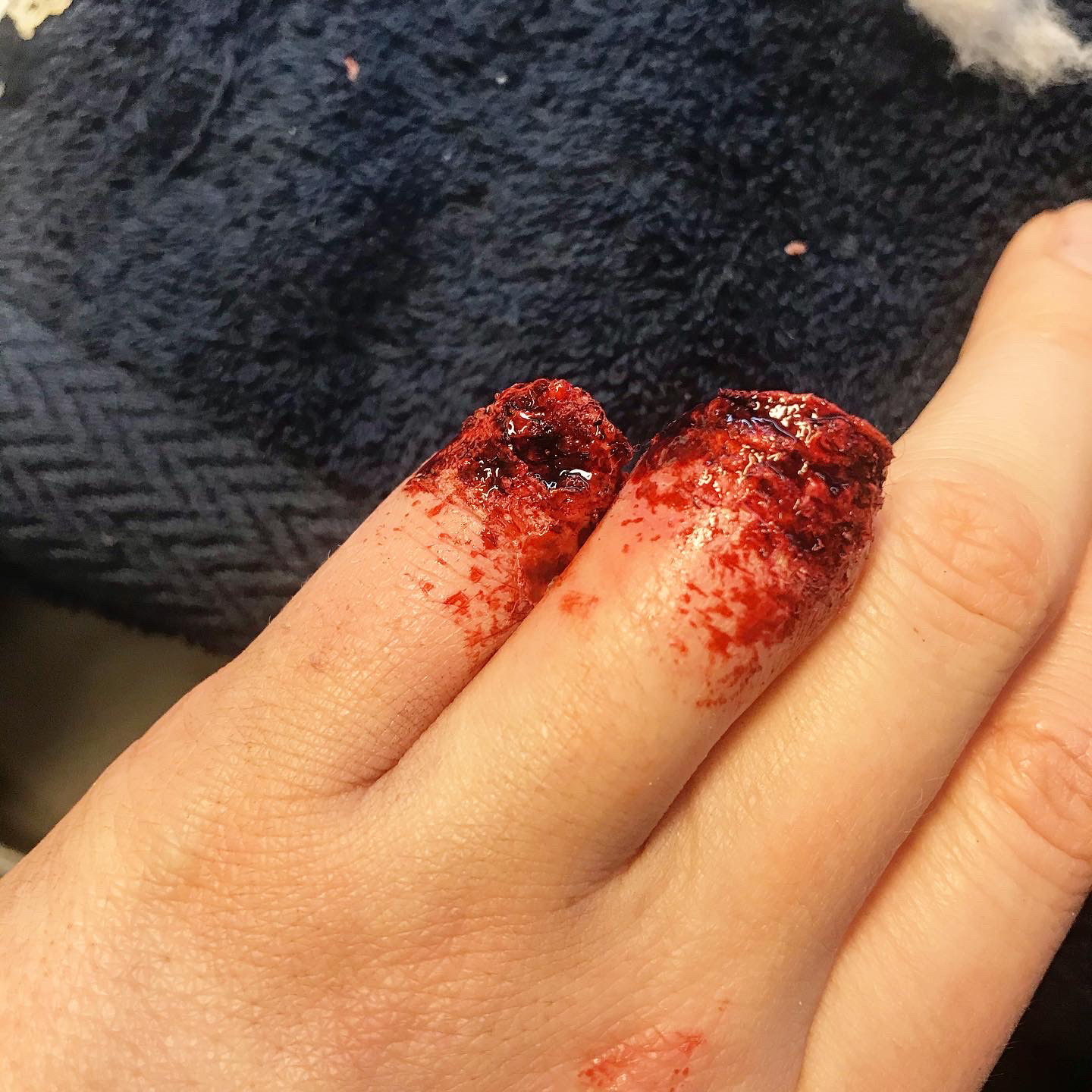 Latex application, torn off fingers