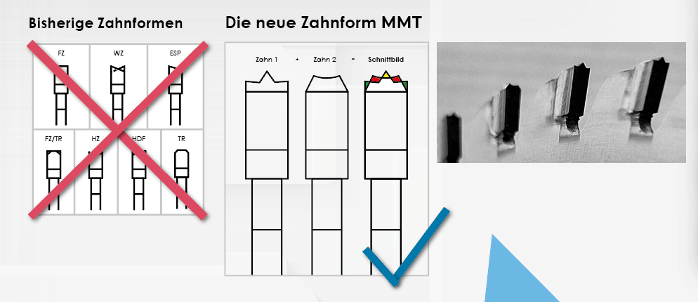 Vorherige Zahnformen vs. MMT