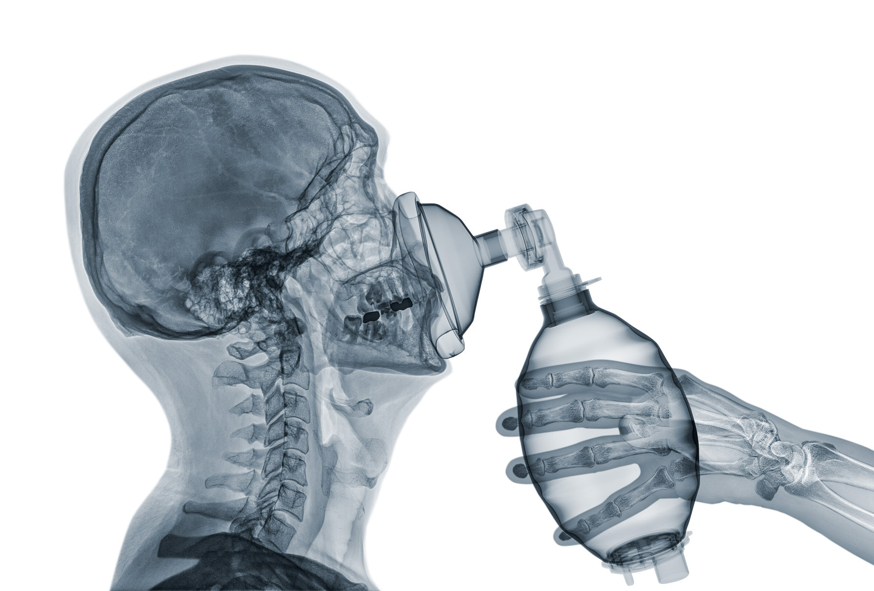 Assisted Respiration