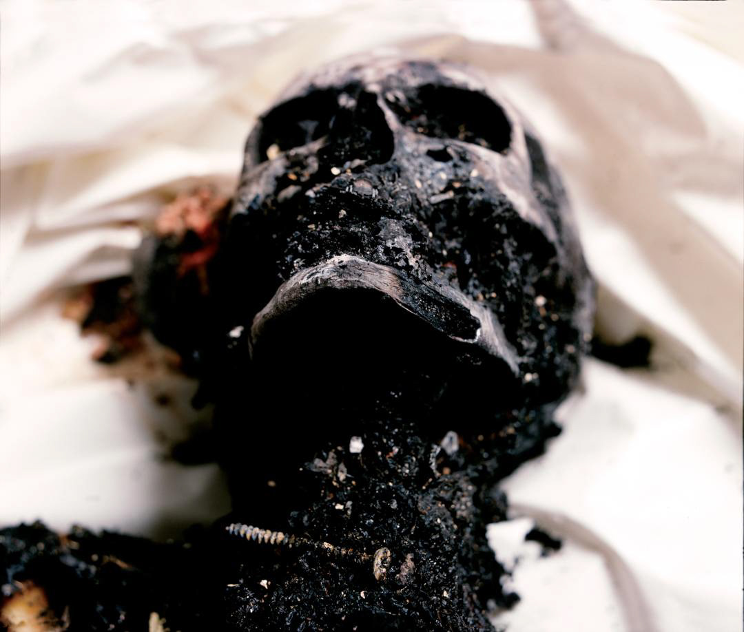Figure 3 - Serrano, Andres. Burnt to Death from The Morgue. 1992. Medium-format photograph. Image courtesy of the artist via andresserrano.org.