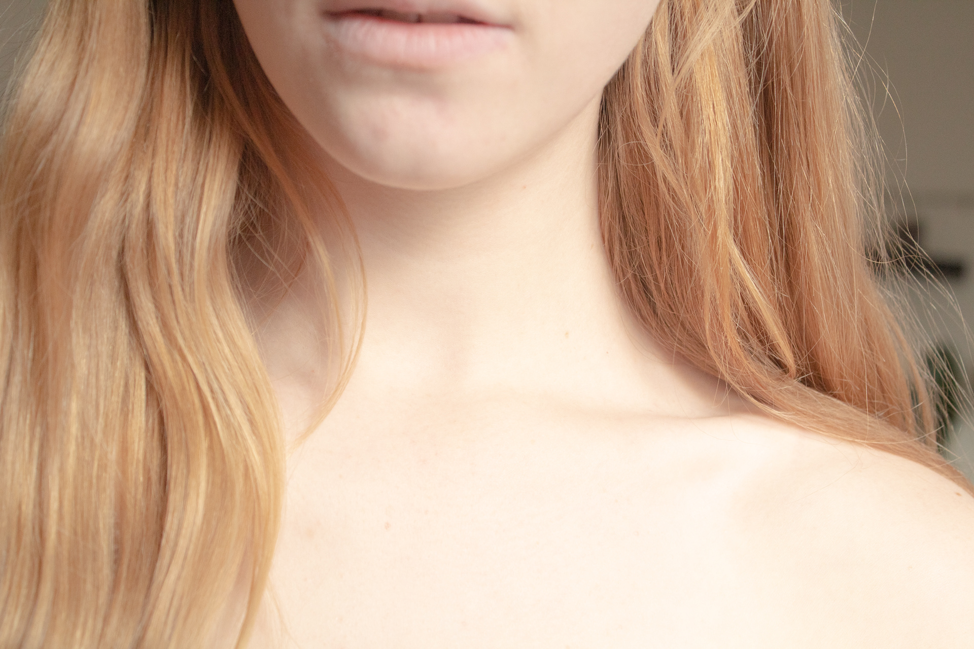 My Skin (Digital Print, 2022)
