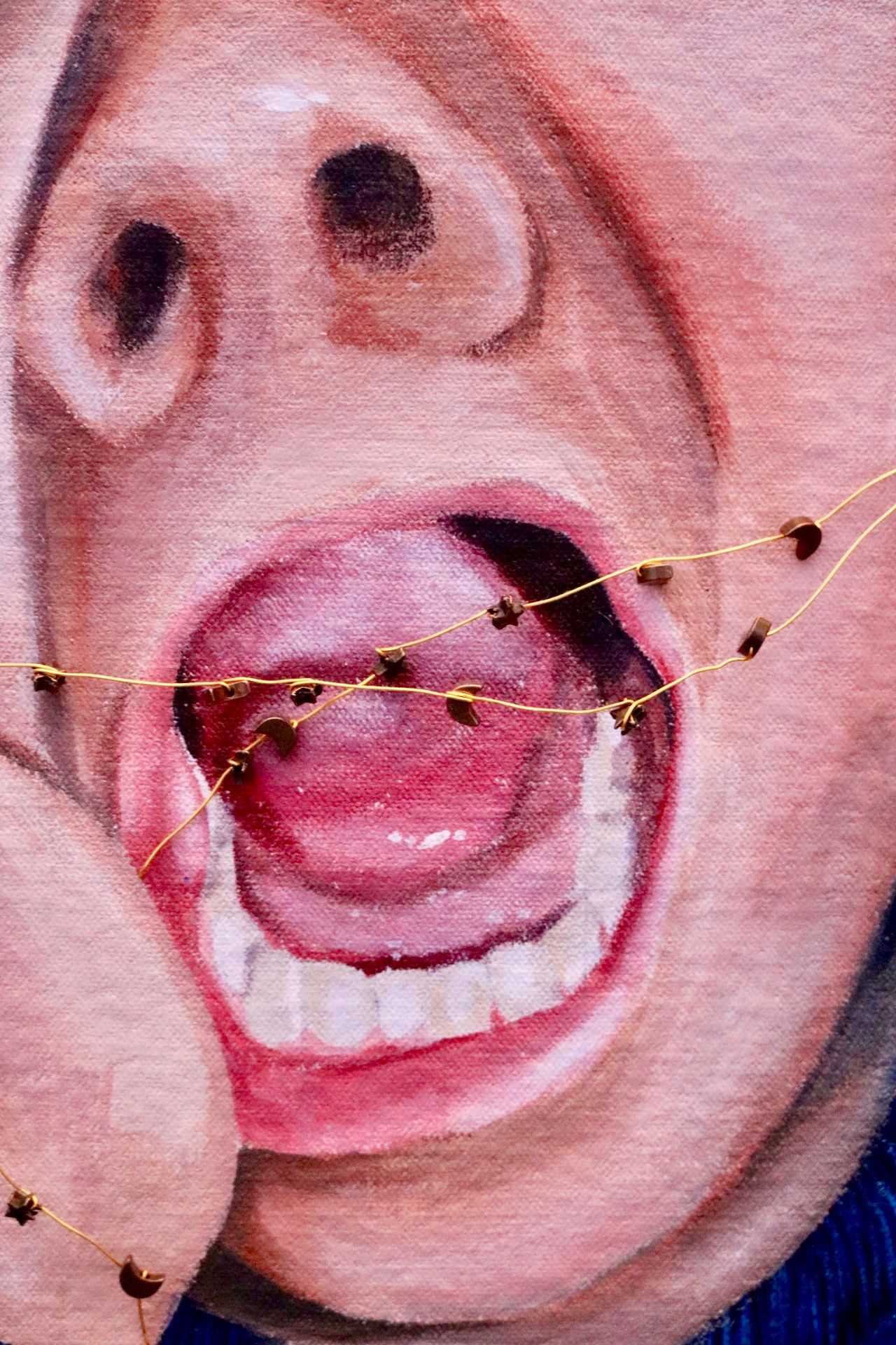 Detail