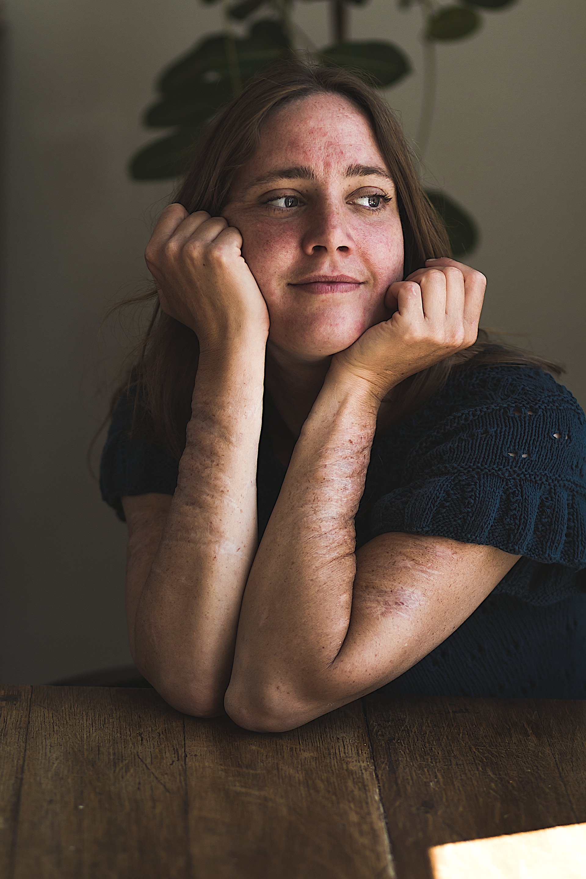 Cecilie Skovbjerg