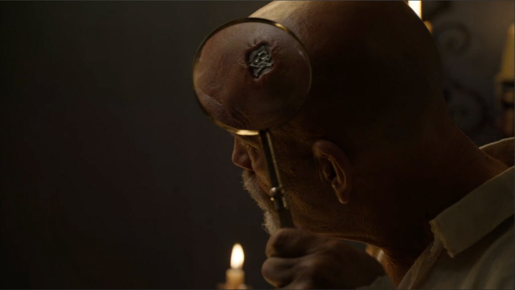 CROSSBONES