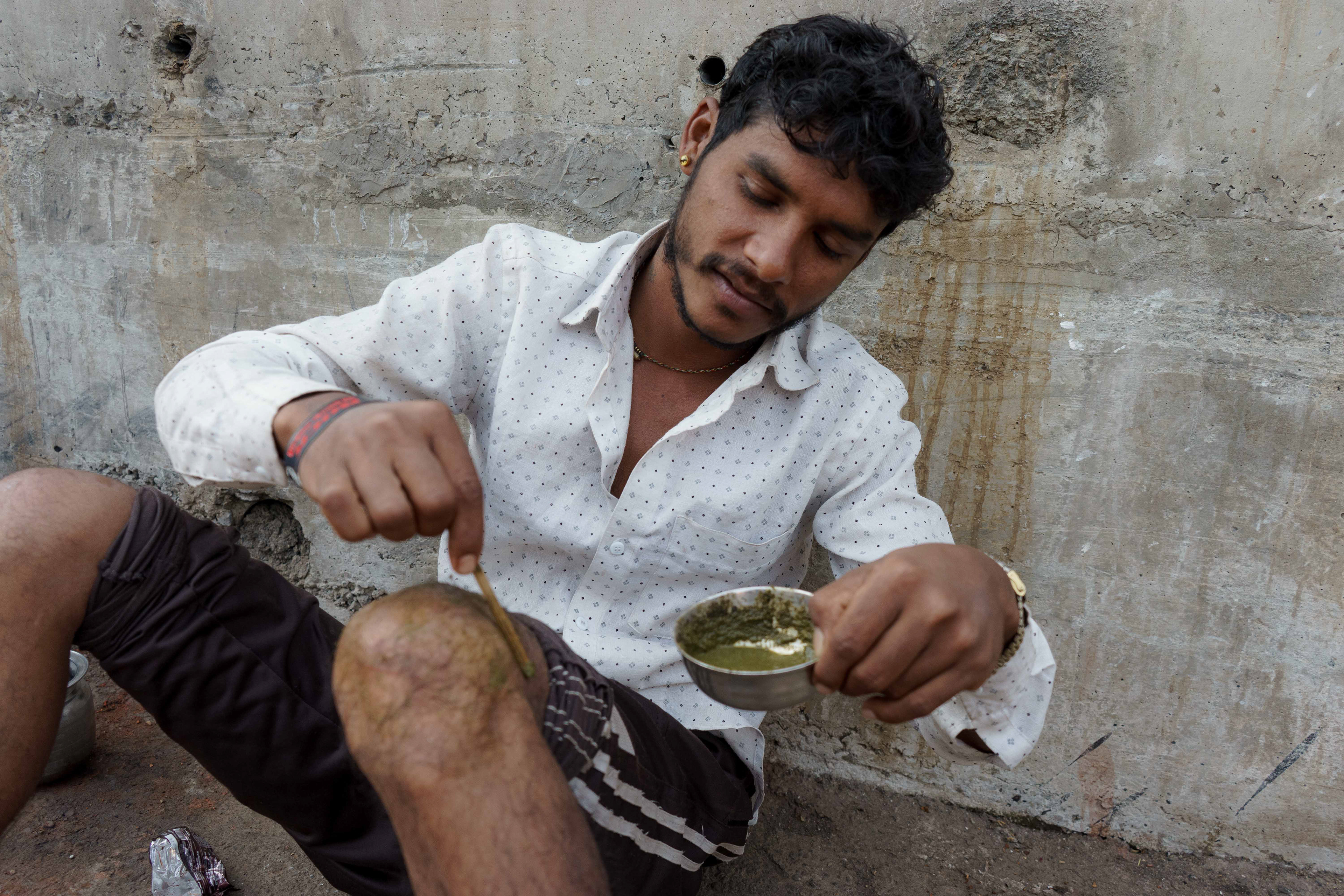 The waste workers are lucky to just get away with skin infections. Neem extract (green residue) is applied for its healing properties for allergies and infections caused by the sewage water.