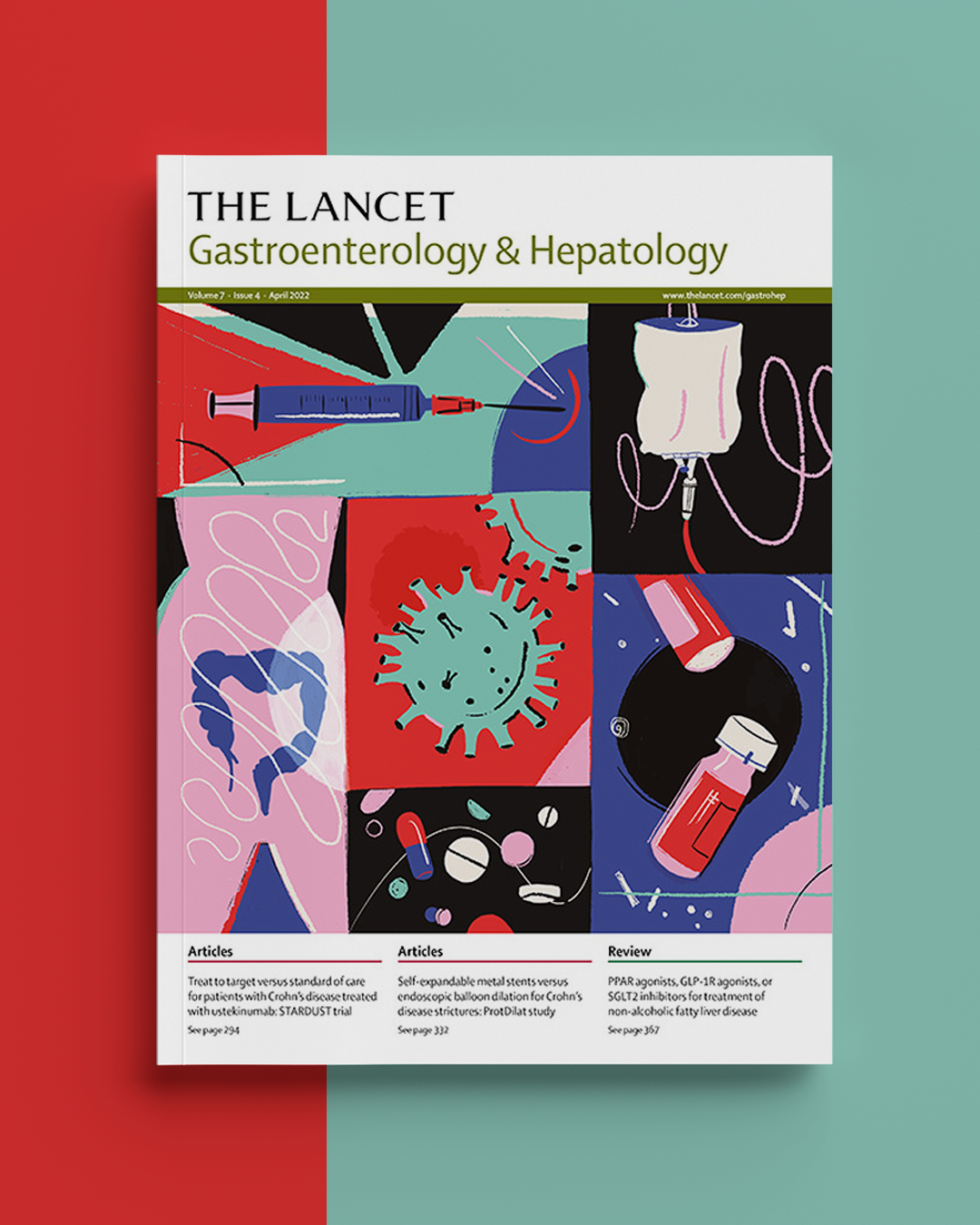 Crohn's disease - The Lancet