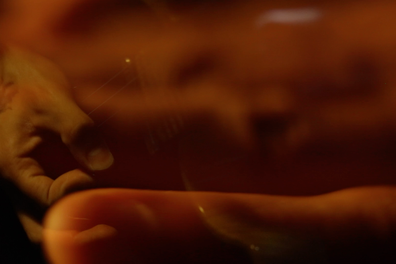 FOTOGRAFÍA: EDNEPHIL