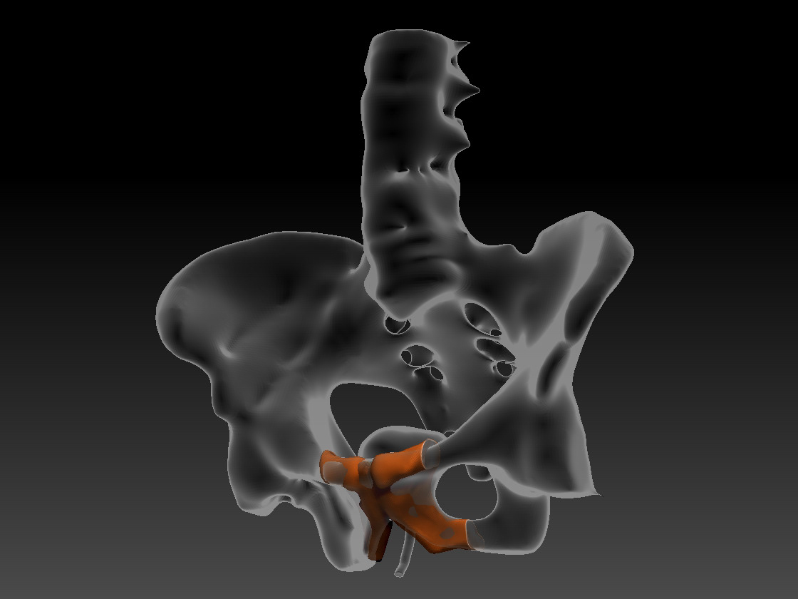Using CT Scan data for medical models (see Medical Model page for more details)