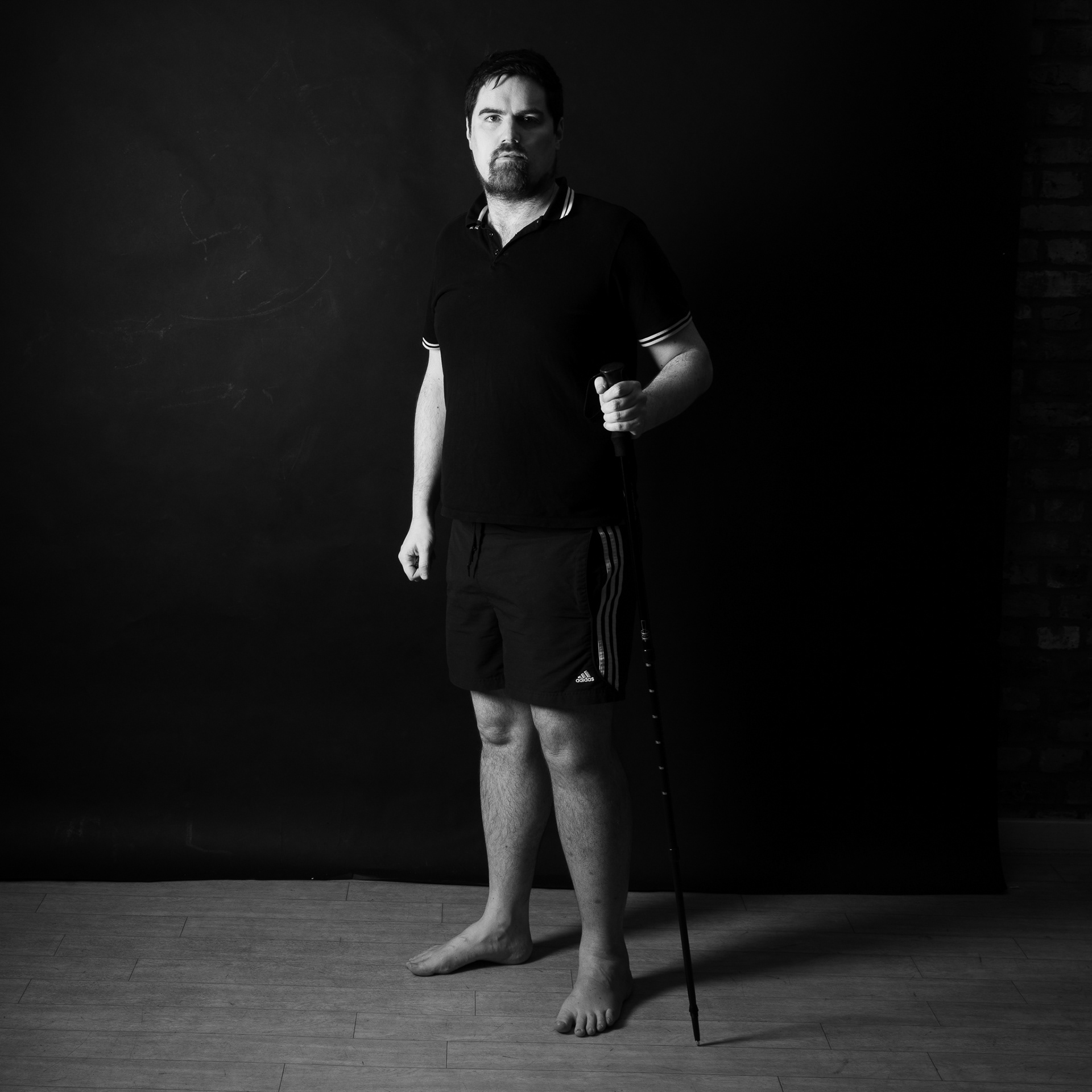DVT: Improvised walking stick