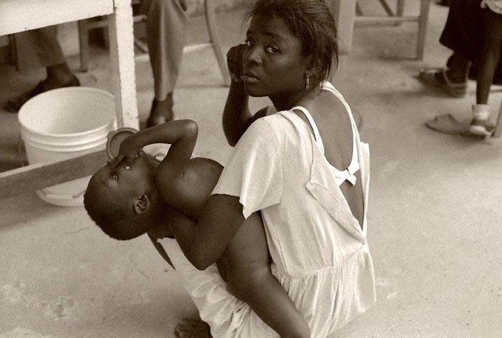 1992 Hospital Albert Schweitzer. The hospital is located in the Lower Artibonite Valley. The 131-bed is the only 24/7 full-service hospital serving a population roughly the size of Anaheim, California.