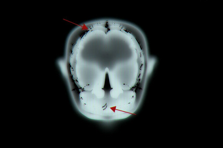 911 Season 1 - MRI Scan - Model, texture, render - Maya, V-Ray, Photoshop