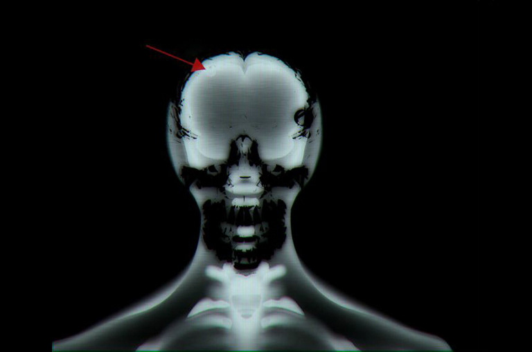 911 Season 1 - MRI Scan - Model, texture, render - Maya, V-Ray, Photoshop
