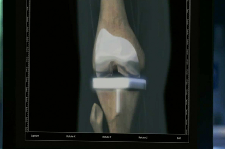 CSI:Miami S4 - CG Bone - Maya & After Effects