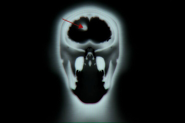 911 Season 1 - MRI Scan - Model, texture, render - Maya, V-Ray, Photoshop