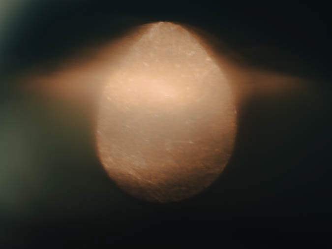 Refraction #1 - Resonance