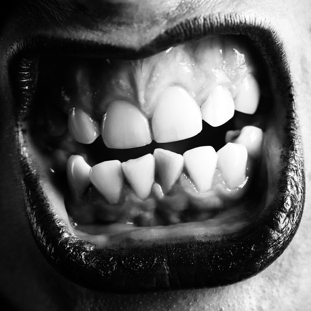 Anger