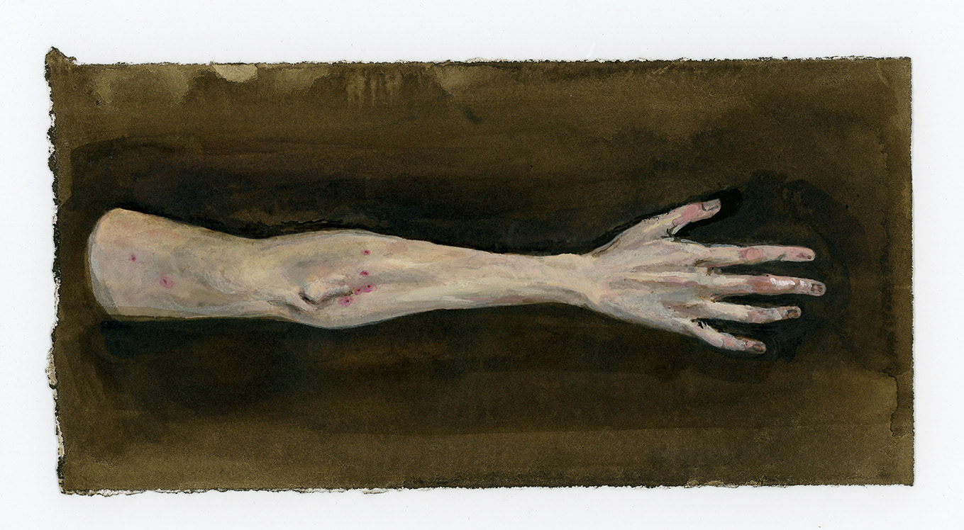 BUG BITES, 2022, gouache and ink on paper