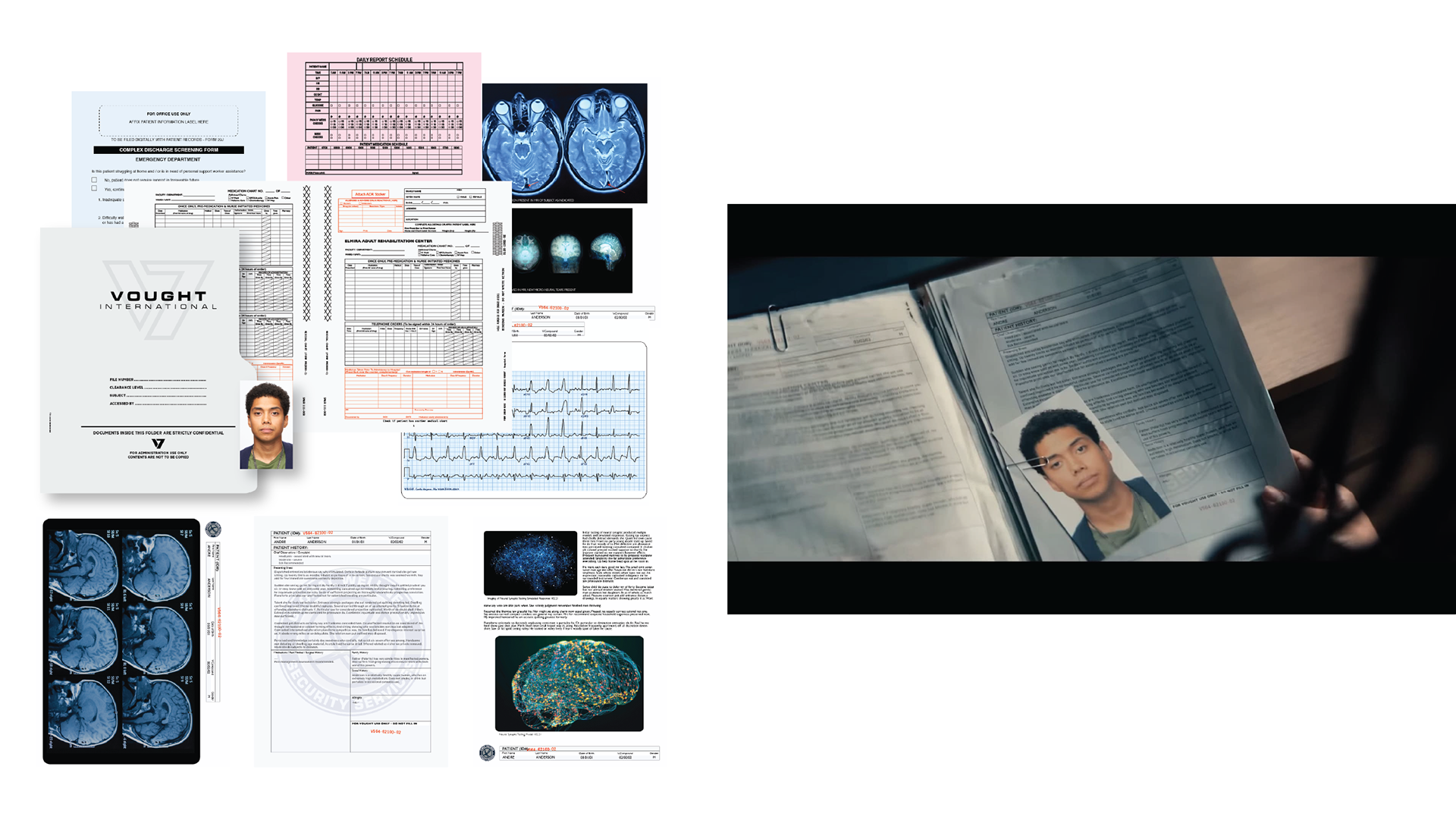Medical folder with xrays and notes.