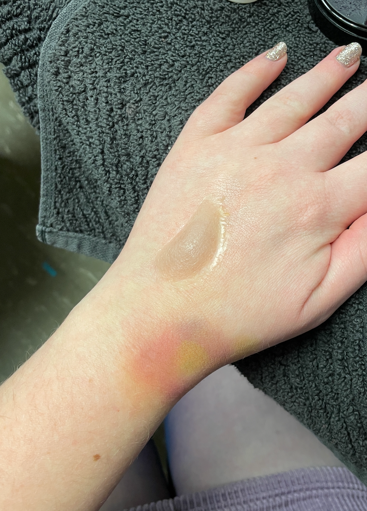 Applied prosthetics and bruise makeup