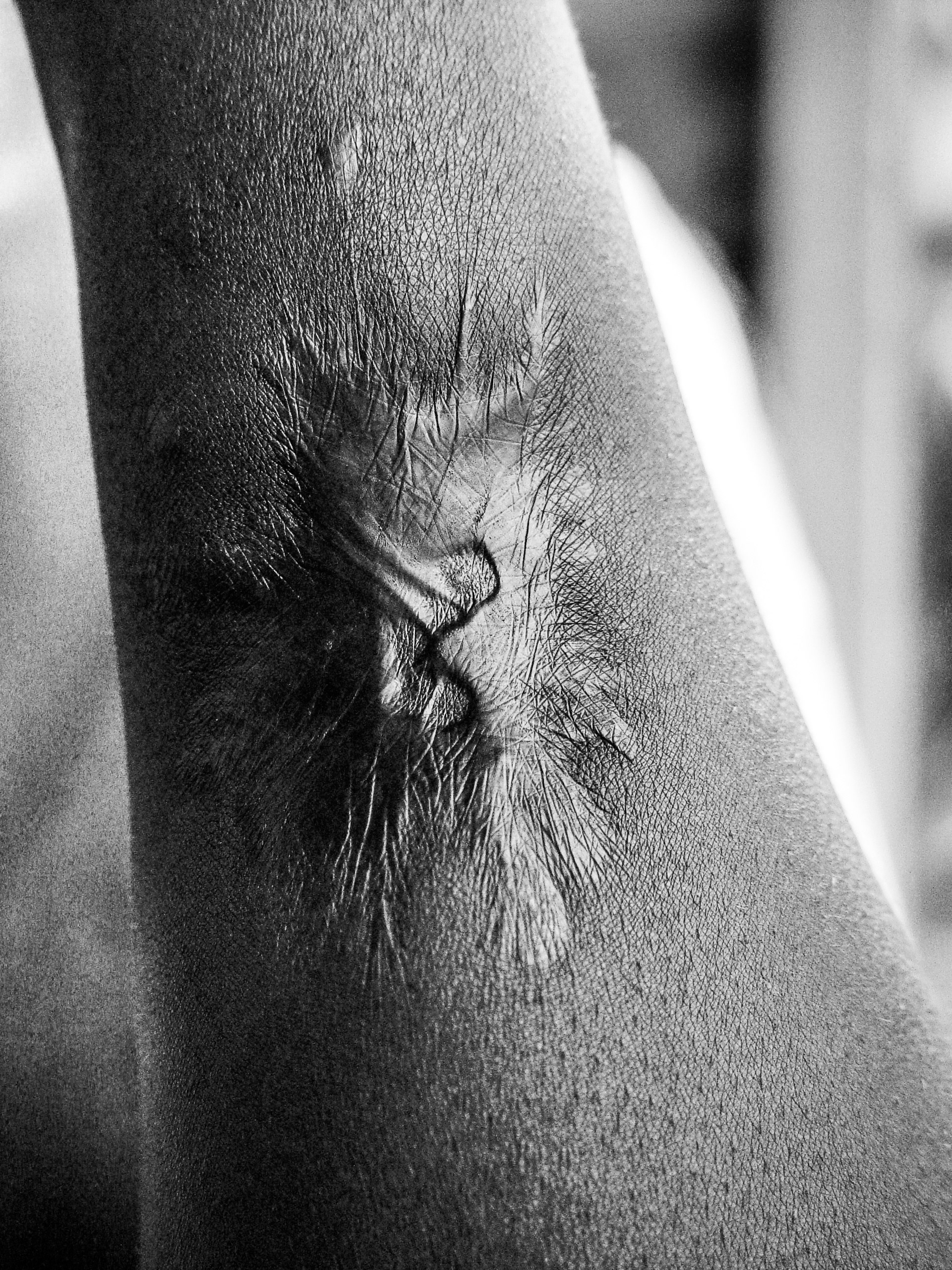 The scar where a survivor was shot in the arm. A permanent and poignant reminder of their past.