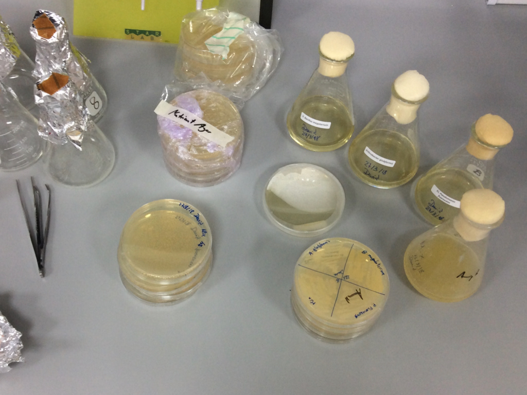Biology experiment with three bacteria that informed the speculative design of the Digester