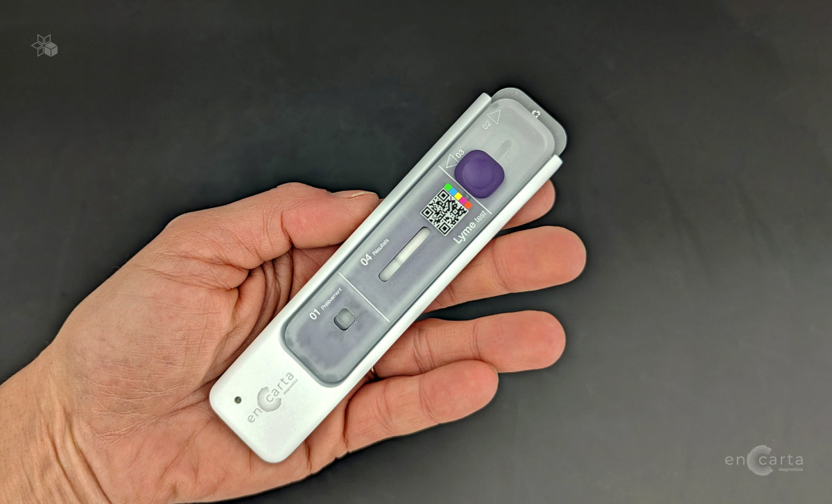 Prototype du dispositif de diagnostic En Carta, réalisé par le studio de Design industriel indigo designs